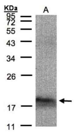 MANF Antibody, Novus Biologicals 0.1mg; Unlabeled:Antibodies, Polyclonal