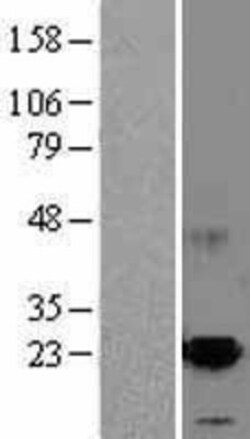 Novus Biologicals™ MANF Overexpression Lysate