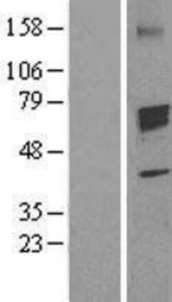 Novus Biologicals™ Aromatase Overexpression Lysate