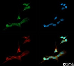Aromatase Antibody, Novus Biologicals 0.1mL; Unlabeled:Antibodies, Polyclonal