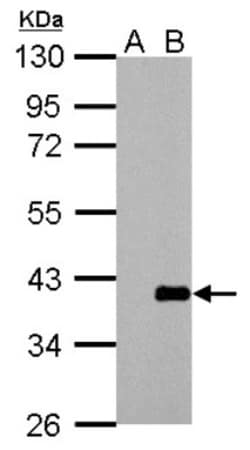 ARPC1A Antibody, Novus Biologicals 0.1mL; Unlabeled:Antibodies, Polyclonal