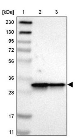 ARPC2 Antibody, Novus Biologicals 0.1mL; Unlabeled:Antibodies, Polyclonal