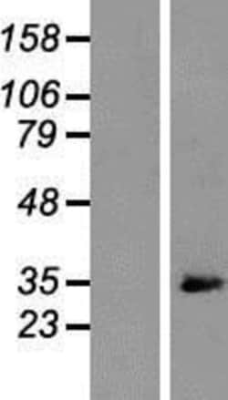 Novus Biologicals&trade;&nbsp;ARPC2 Overexpression Lysate