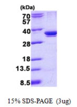 Novus Biologicals&trade;&nbsp;Recombinant Human ARPC2 His Protein
