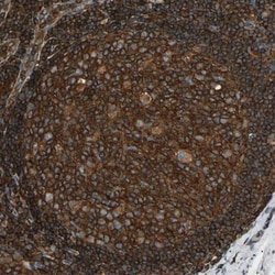 ARPC2 Antibody, Novus Biologicals 0.1mL; Unlabeled:Antibodies, Polyclonal