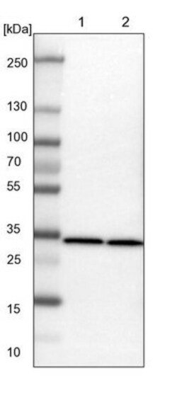 ARPC2 Antibody, Novus Biologicals 0.1mL; Unlabeled:Antibodies, Polyclonal