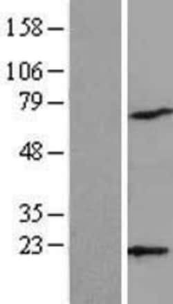 Novus Biologicals&trade;&nbsp;ARPC4 Overexpression Lysate