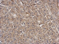 ARPC5L Antibody, Novus Biologicals 0.1mL; Unlabeled:Antibodies, Polyclonal