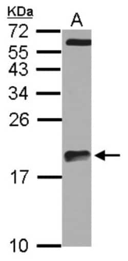 ARPC5L Antibody, Novus Biologicals 0.1mL; Unlabeled:Antibodies, Polyclonal