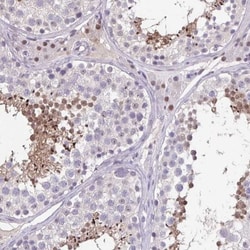 ARPM1 Antibody, Novus Biologicals:Antibodies:Primary Antibodies