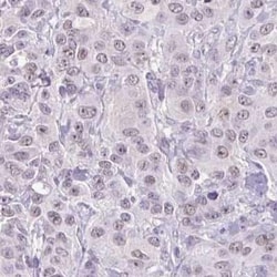 ARPM1 Antibody, Novus Biologicals:Antibodies:Primary Antibodies