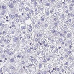 ARPP19 Antibody, Novus Biologicals 0.1mL; Unlabeled:Antibodies, Polyclonal