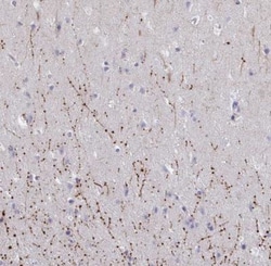 ARPP19 Antibody, Novus Biologicals 0.1mL; Unlabeled:Antibodies, Polyclonal