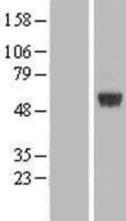 Novus Biologicals™ ARRDC1 Overexpression Lysate