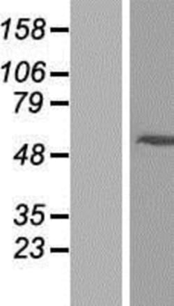 Novus Biologicals™ ARRDC2 Overexpression Lysate