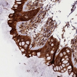 ARRDC4 Antibody, Novus Biologicals:Antibodies:Primary Antibodies