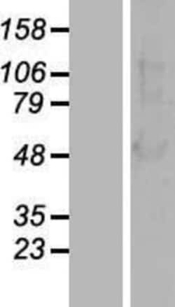 Novus Biologicals&trade;&nbsp;beta-Arrestin 1 Overexpression Lysate