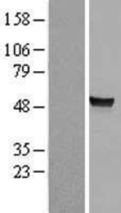Novus Biologicals&trade;&nbsp;Arylsulfatase A/ARSA Overexpression Lysate