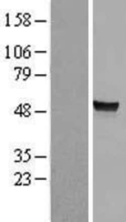 Novus Biologicals&trade;&nbsp;Arylsulfatase A/ARSA Overexpression Lysate