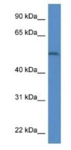 Arylsulfatase B/ARSB Antibody, Novus Biologicals:Antibodies:Primary Antibodies