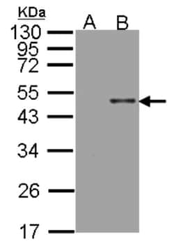 Arylsulfatase B/ARSB Antibody, Novus Biologicals 0.1mL; Unlabeled:Antibodies,