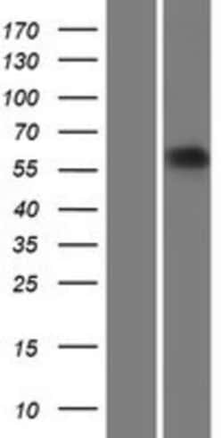 Novus Biologicals&trade;&nbsp;ARSE Overexpression Lysate