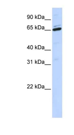 ARSH Antibody, Novus Biologicals:Antibodies:Primary Antibodies