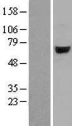 Novus Biologicals™ ARSJ Overexpression Lysate
