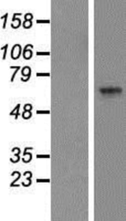 Novus Biologicals™ ARSK Overexpression Lysate