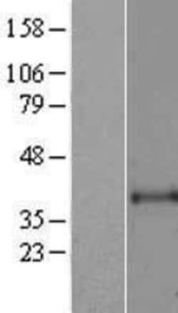 Novus Biologicals&trade;&nbsp;ART1 Overexpression Lysate