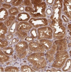 ART1 Antibody, Novus Biologicals 25 &mu;L, Unlabeled:Antibodies, Polyclonal
