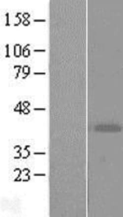 Novus Biologicals™ ART4 Overexpression Lysate