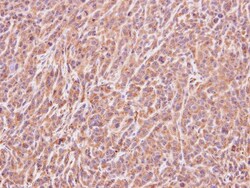 ART5 Antibody, Novus Biologicals 0.1mg; Unlabeled:Antibodies, Polyclonal