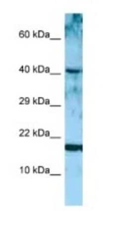 Artemin Antibody, Novus Biologicals 100&mu;L; Unlabeled:Antibodies, Polyclonal