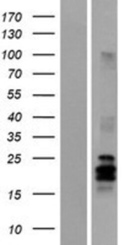 Novus Biologicals&trade;&nbsp;Artemin Overexpression Lysate