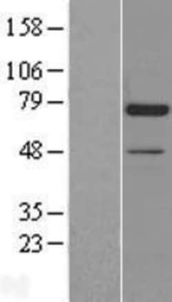 Novus Biologicals&trade;&nbsp;Artemis Overexpression Lysate