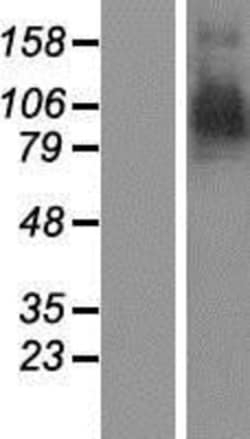 Novus Biologicals&trade;&nbsp;Aminopeptidase PILS/ARTS1 Overexpression Lysate