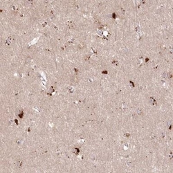 Arylsulfatase B/ARSB Antibody, Novus Biologicals 0.1mL; Unlabeled:Antibodies,