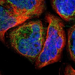 Arylsulfatase D Antibody, Novus Biologicals 0.1mL; Unlabeled:Antibodies,