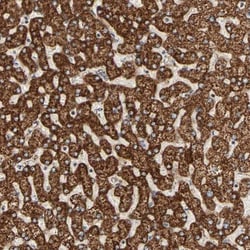 Arylsulfatase D Antibody, Novus Biologicals 0.1mL; Unlabeled:Antibodies,