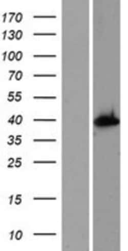 Novus Biologicals&trade;&nbsp;AS3MT Overexpression Lysate