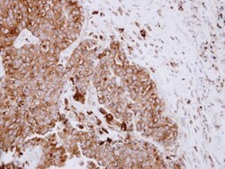 ASAH1 Antibody, Novus Biologicals 0.1mL; Unlabeled:Antibodies, Polyclonal
