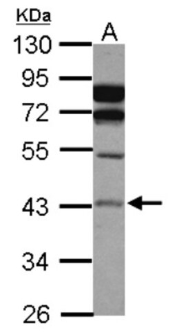 ASAH1 Antibody, Novus Biologicals 0.1mL; Unlabeled:Antibodies, Polyclonal