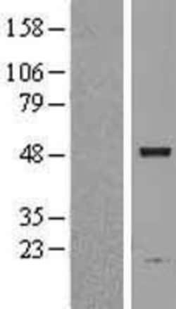 Novus Biologicals&trade;&nbsp;ASAH1 Overexpression Lysate