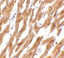 ASAH1 Antibody - BSA Free, Novus Biologicals 0.1mg; Unlabeled:Antibodies,