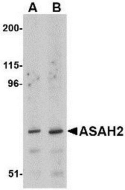 ASAH2/N-acylsphingosine Amidohydrolase-2 Antibody - BSA Free, Novus Biologicals