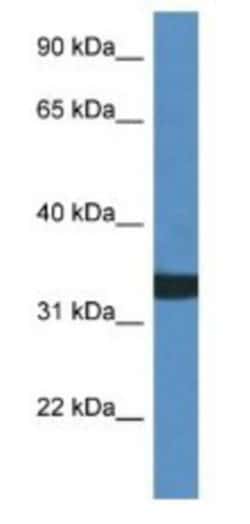 ASAH3 Antibody, Novus Biologicals 100 &mu;L | Buy Online | Novus Biologicals | Fisher Scientific