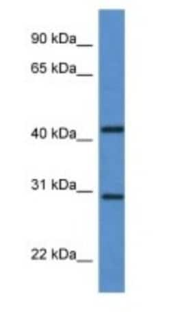 ASAH3 Antibody, Novus Biologicals 100 &mu;L | Buy Online | Novus Biologicals | Fisher Scientific