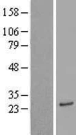 Novus Biologicals&trade;&nbsp;ASAH3 Overexpression Lysate