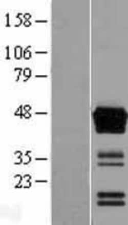 Novus Biologicals&trade;&nbsp;ASAM Overexpression Lysate